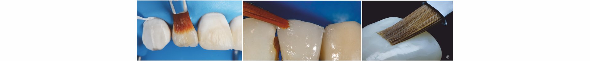 dental brush