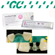 GC EverStick