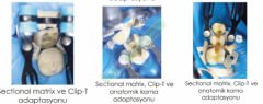TECCI CLIP-T