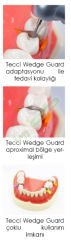 TECCI WEDGE GUARD