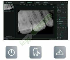 Woodpecker i-Sensor H1 Dijital X-Ray RVG Görüntüleme Sistemi