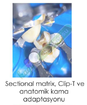 TECCI SECTİONAL MATRİX - 800 SERİES