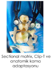 TECCI SECTİONAL MATRİX - 800 SERİES
