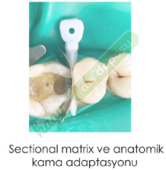 TECCI SECTİONAL MATRİX - 800 SERİES