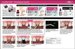 G-CEM ONE Self-adhesive Resin Siman