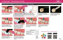 G-CEM ONE Self-adhesive Resin Siman