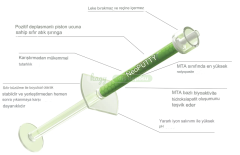 NuSmile NeoPUTTY Bioseramik içerikli MTA