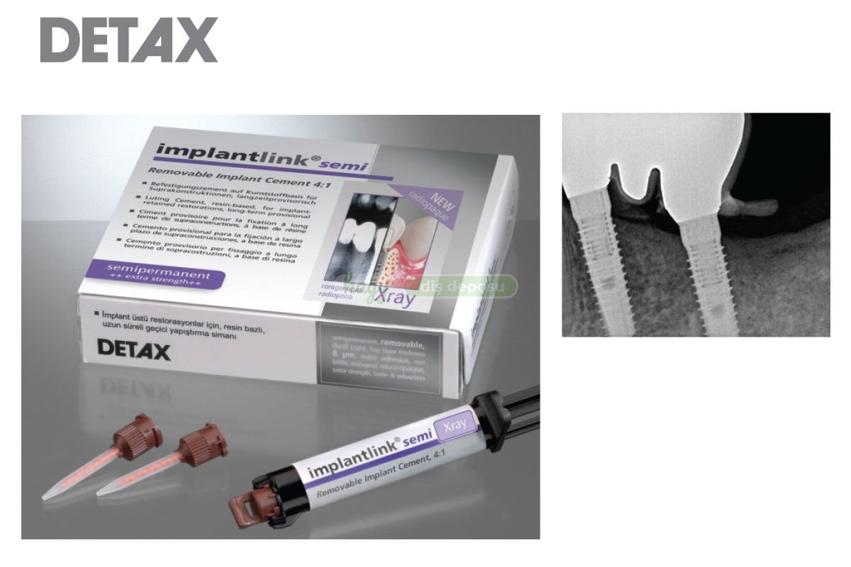 Detax Implantlink® Semi X-Ray