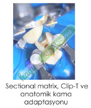 TECCI SECTİONAL MATRİX - 900 SERİES