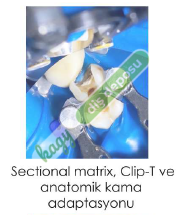 TECCI SECTİONAL MATRİX - 720 SERİES