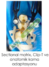 TECCI SECTİONAL MATRİX - 720 SERİES