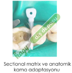 TECCI SECTİONAL MATRİX - 720 SERİES
