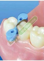 Tecci Promotion Sectional Matrix Kit 2